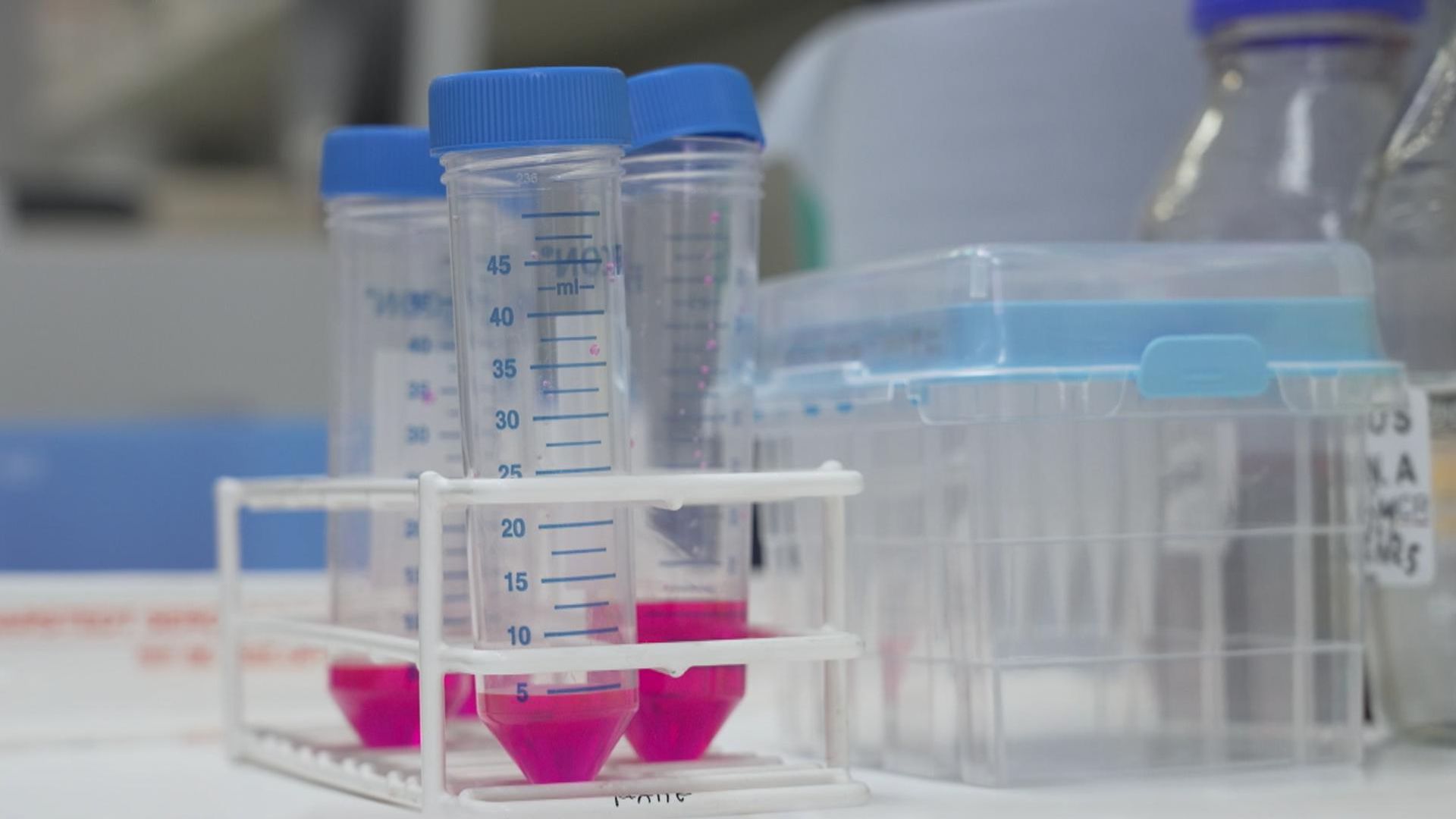 ‘Game-changing’ drug that slows incurable breast cancer approved for NHS