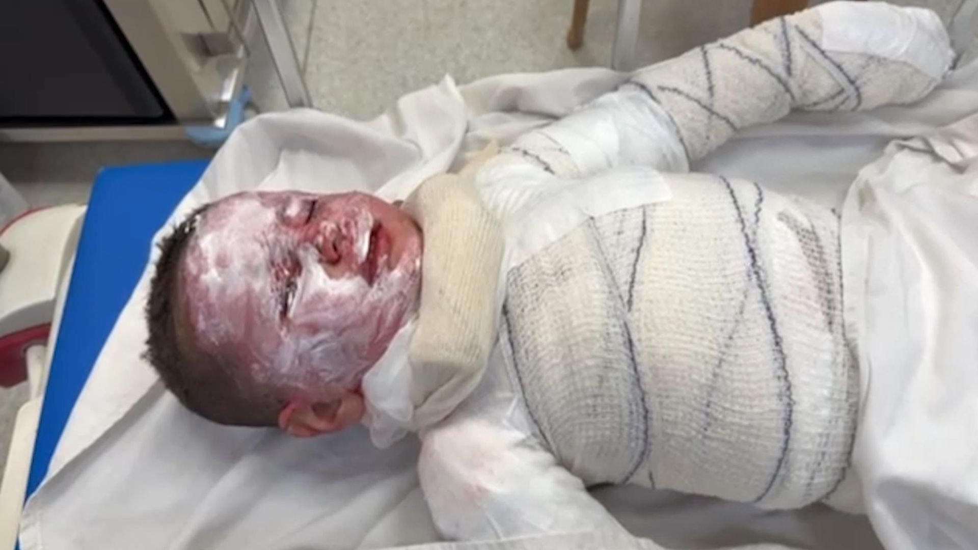 ‘What did they do to be burned and bombed?’: Charity calls on UK to offer Gaza children life-saving treatment